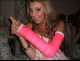 My pink arm cast